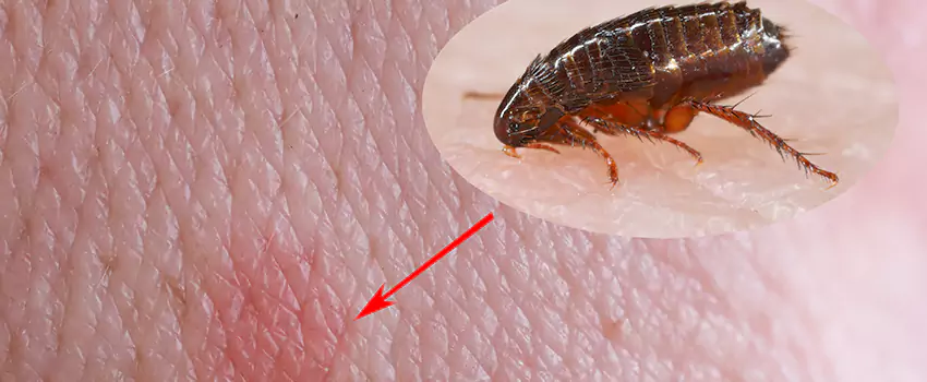 Flea Control for Humans Flower Mound, TX